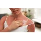 5 способов облегчить состояние кожи после солнечного ожога